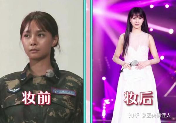 原来沈梦辰&大s是这么美白的!深扒美白你不知道的事?