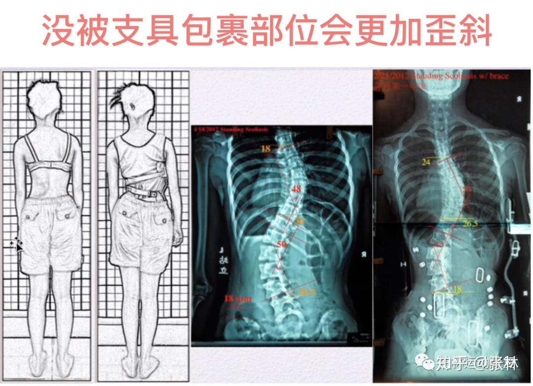 重力中心线是通过我们的两腿正中央,然后通过我们的尾椎,向上通过我们