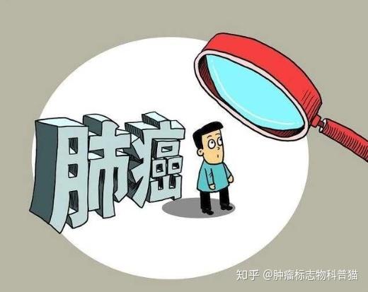 肺癌的临床表现有哪些?