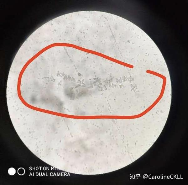 兽医:初步诊断是磷酸铵镁结晶(也就是鸟粪石,鸟粪石通常要到狗狗