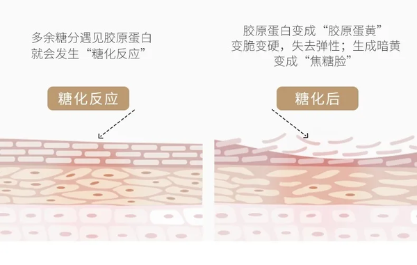 糖化反应的过程:破坏胶原蛋白,变成"焦糖脸"