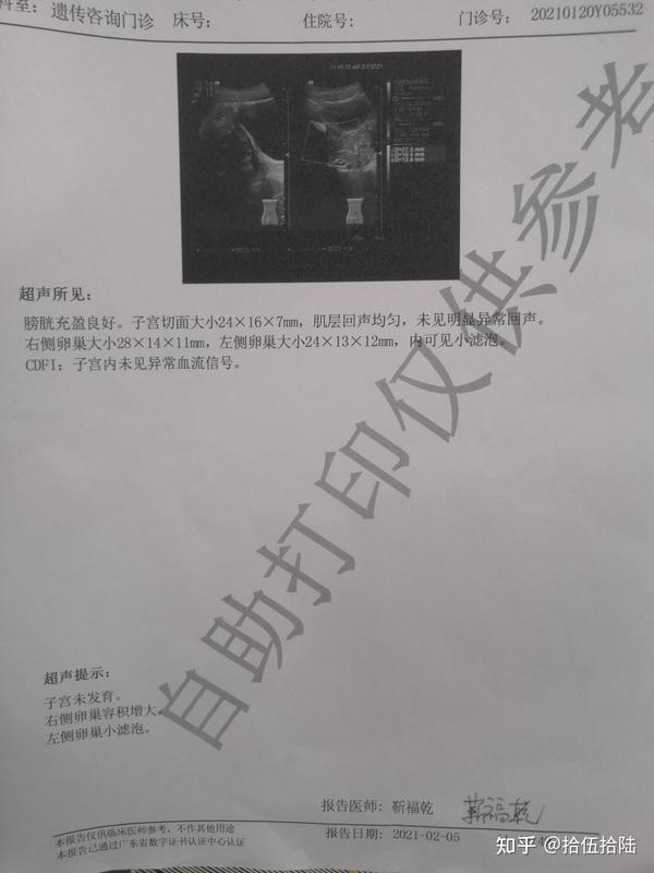 骨龄偏大2岁,记录治疗青春期发育过早/青春期加速