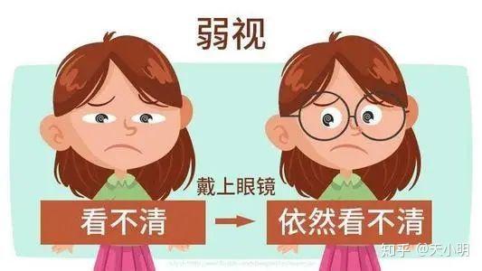 孩子两只眼睛视力不一样,家长不要掉以轻心 知乎