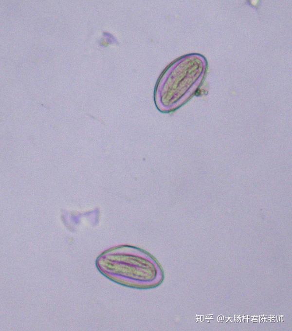 蛲虫的卵,用光学显微镜可以看到内部结构
