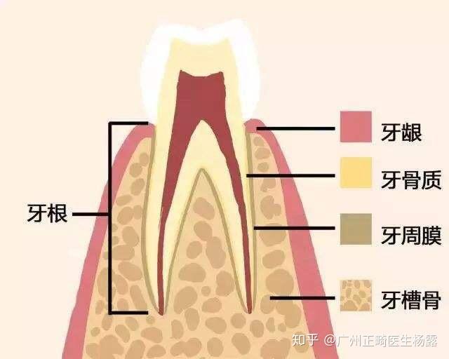 广州正畸医生杨露:什么是牙龈炎?