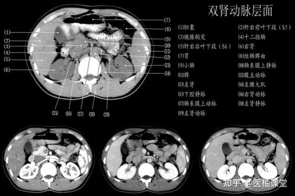 双肾动脉层面