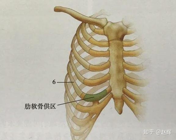 为什么肋软骨隆鼻的风这么大?