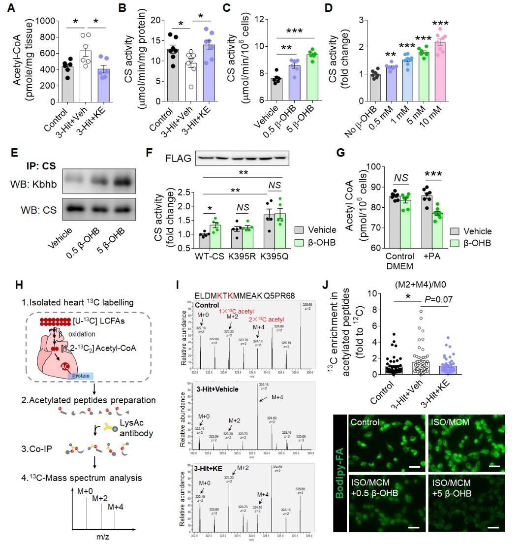 Circulation Research酮体β 羟丁酸靶向调控线粒体 炎症环路减轻HFpEF 知乎