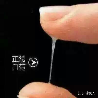 性生活接触性出血查分泌物过氧化氢阳性是什么意思