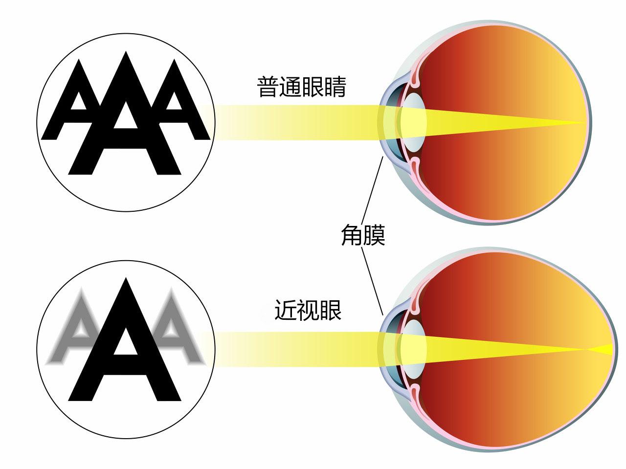 龙达聊哺光系列哺光仪的原理