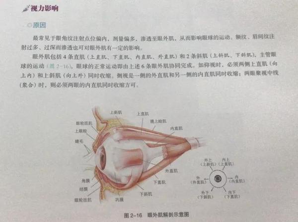 眼外肌解剖示意图如下↓↓