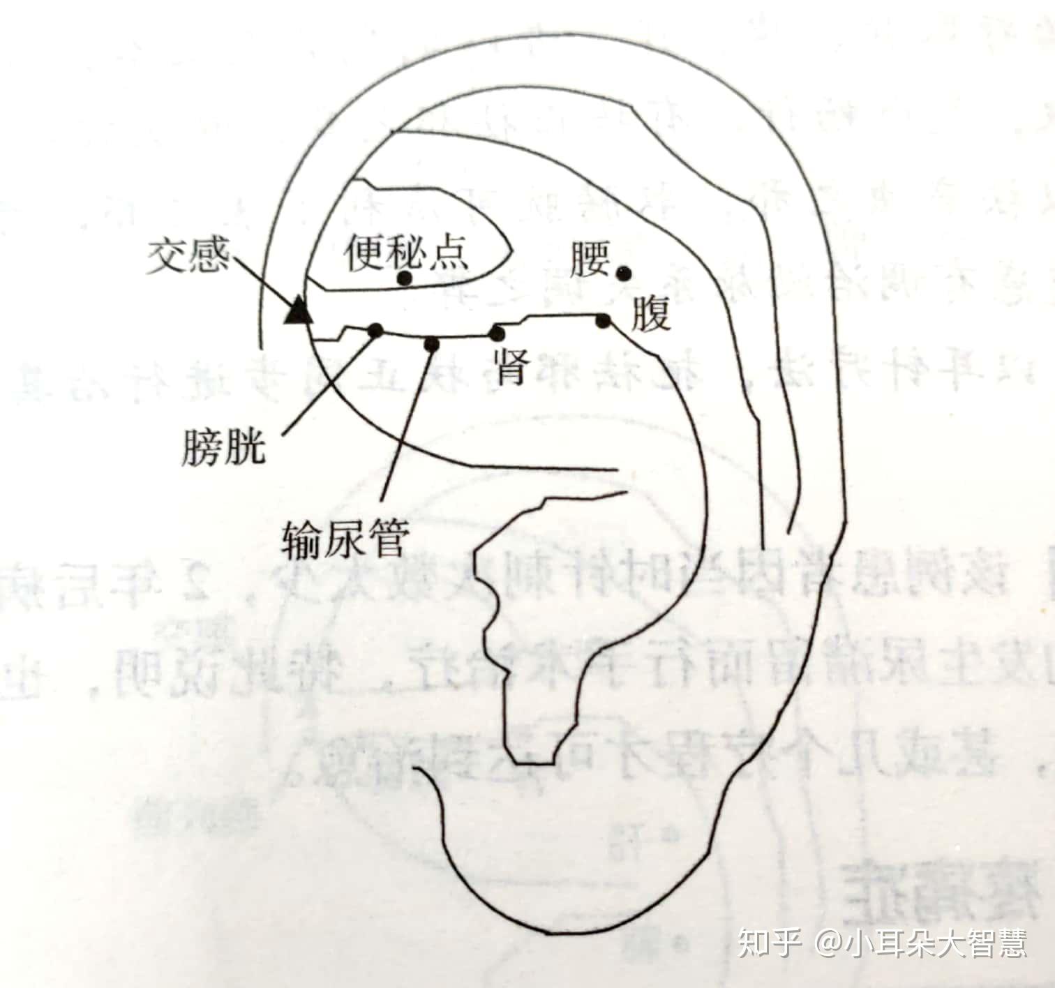 看我如何用耳穴终结肾结石反复发作,搬走你通往健康路