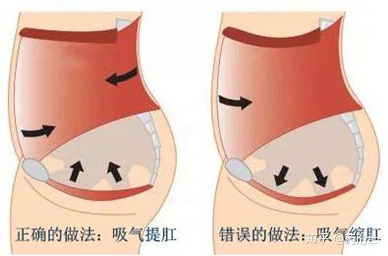 痔疮手术后肛门水肿怎么办?