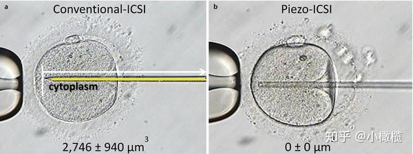 piezo-icsi