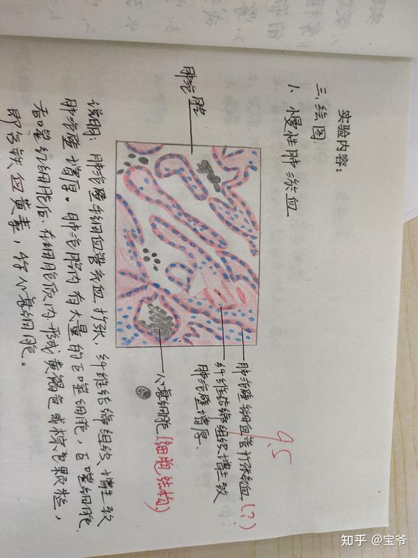 病理学切片红蓝铅笔