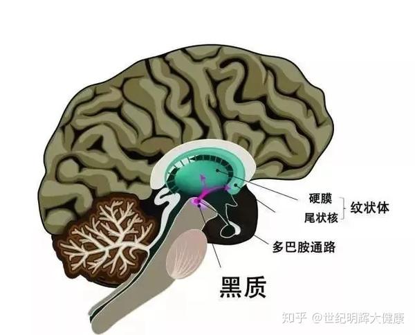 帕金森氏病最主要的病理改变是中脑黑质多巴胺(dopamine, da)能神经