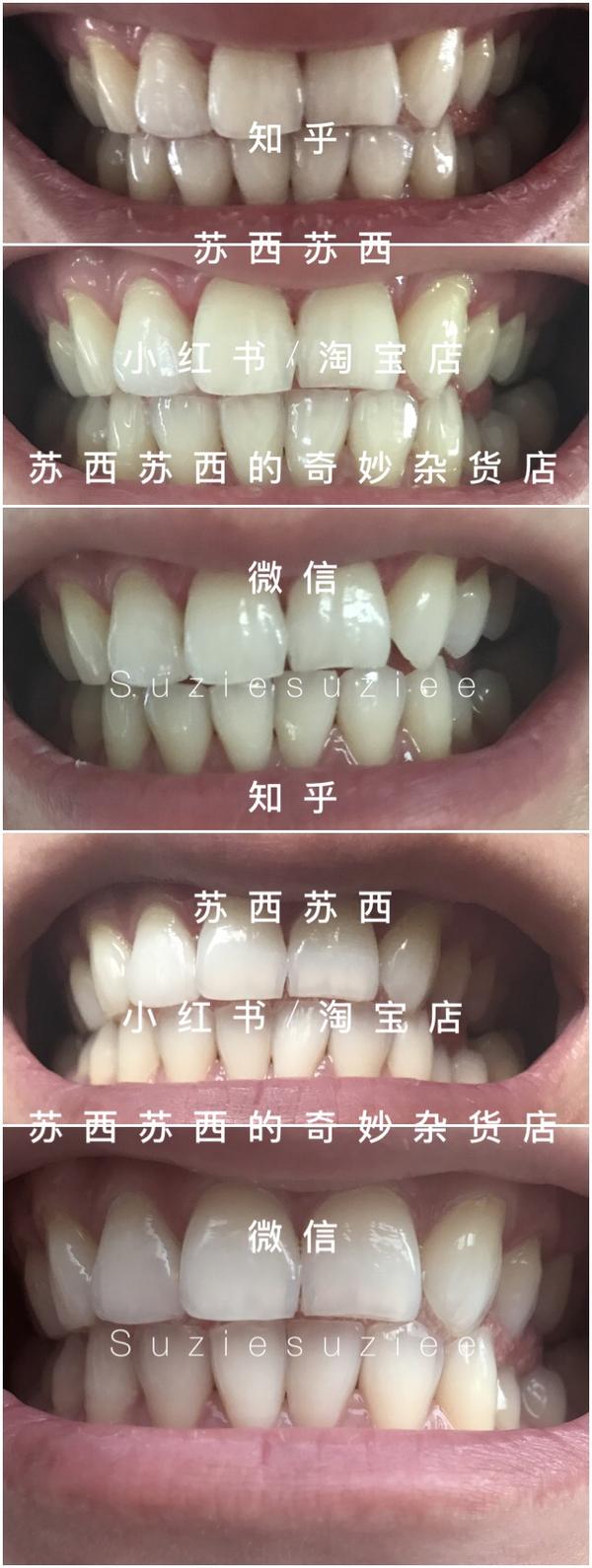 我特地只做了上排牙齿.