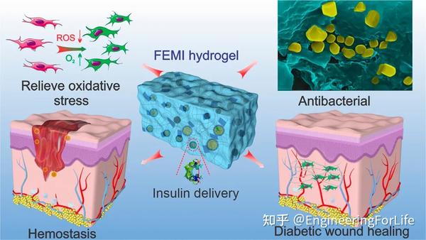 抗菌,抗氧化,降血糖多功能可注射水凝胶促进糖尿病伤口修复方案