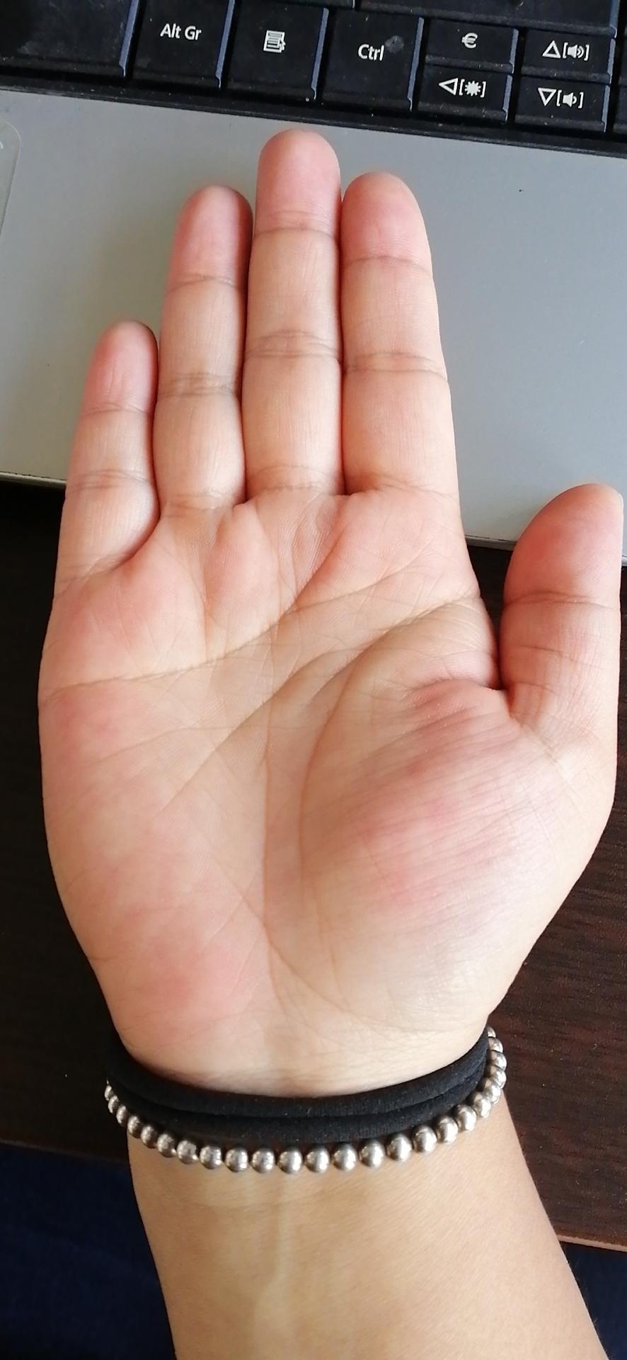 朋友说我掌纹奇怪,我就不晓得哪里奇怪,求个会看掌纹的老师解说一二