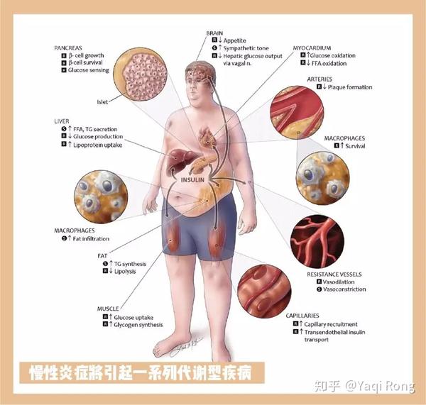 要减重请先缓解体内的慢性炎症