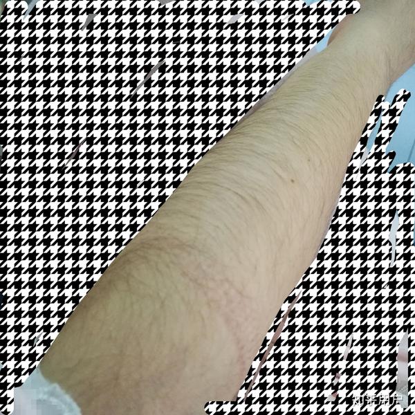 女生长浓密手毛是一种什么样的体验?