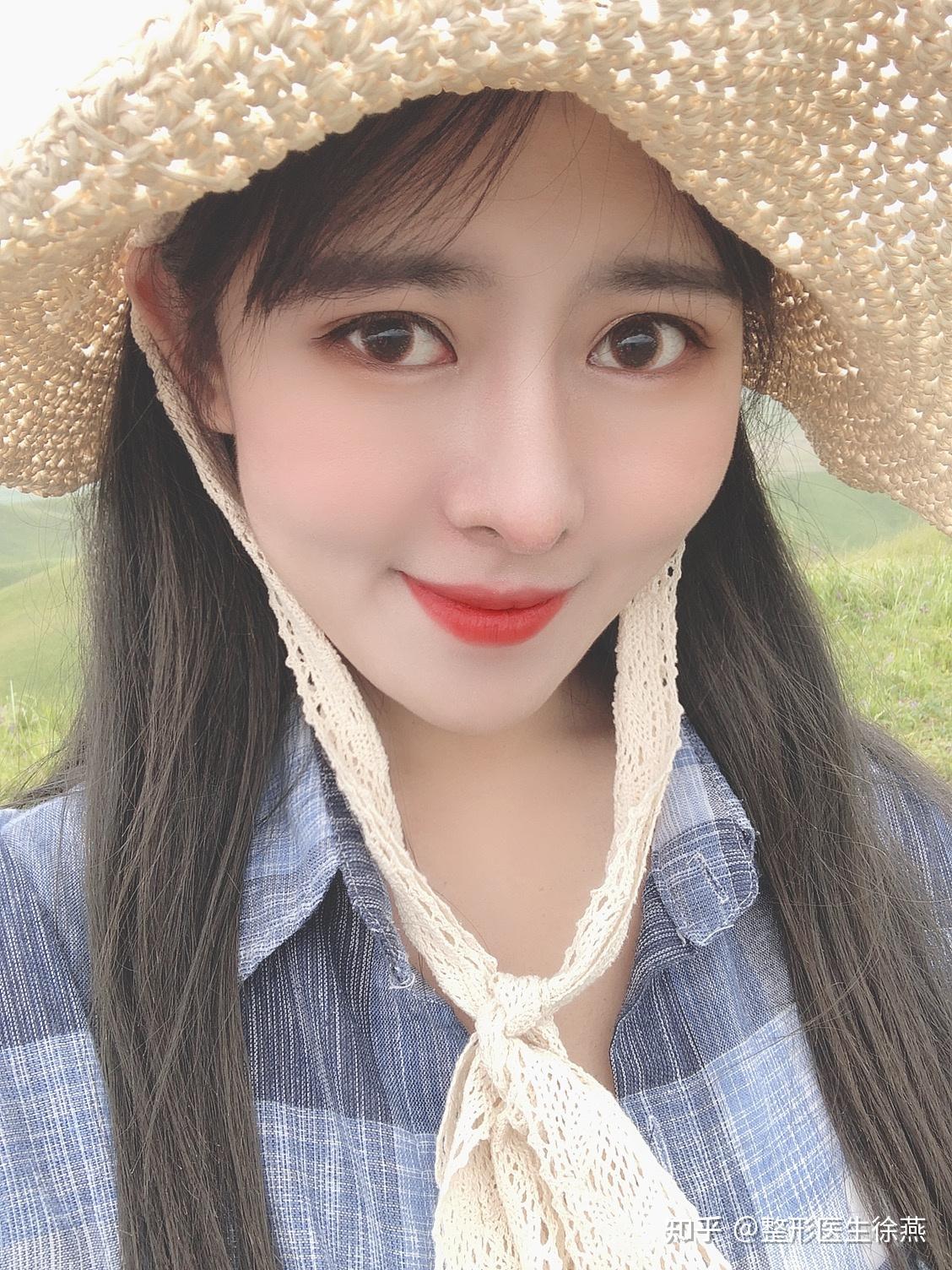做完隆鼻后会后悔吗