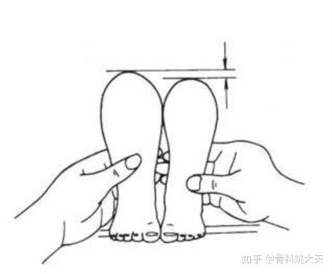 宝宝腿纹不对称,其实暗藏"悬"机