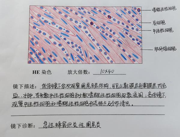 病理学红蓝铅笔图集