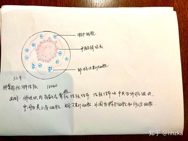 病理学切片红蓝铅手绘图