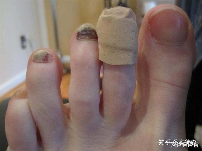 黑指甲代表跑马荣耀