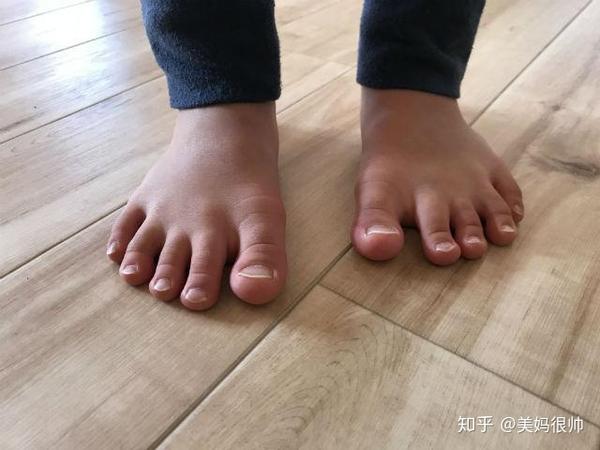 日本"赤足教育"火了:光脚与从不光脚走路,孩子10年后显差距