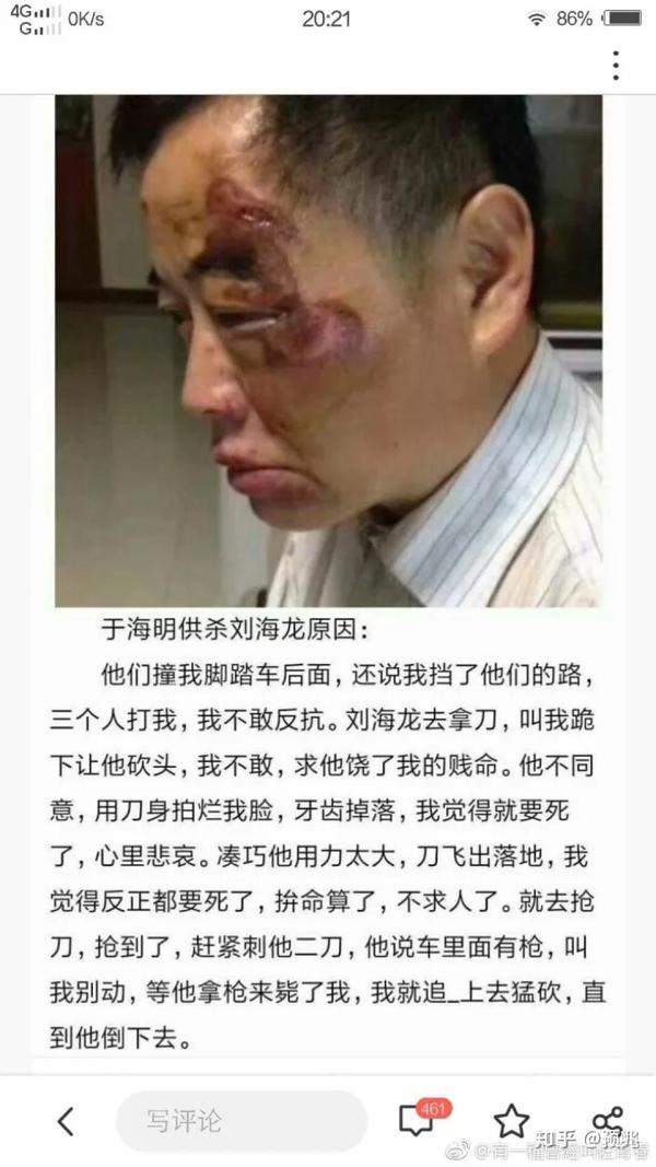 如何看待昆山震川路龙哥砍人被反杀事件?被砍男子行为