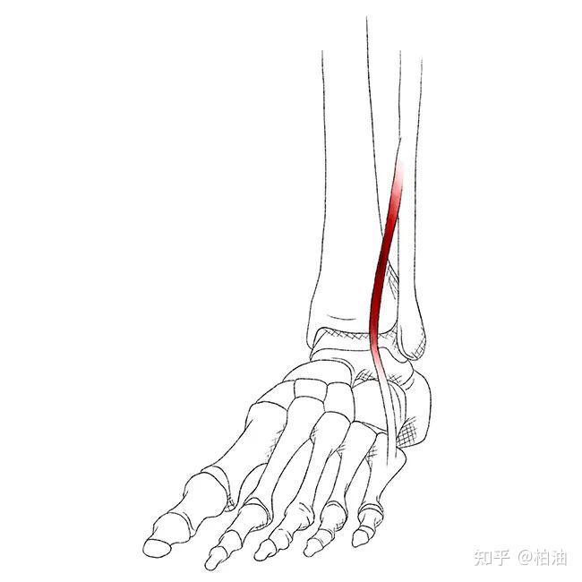 小腿和踝关节外侧疼痛可能是腓骨肌的扳机点