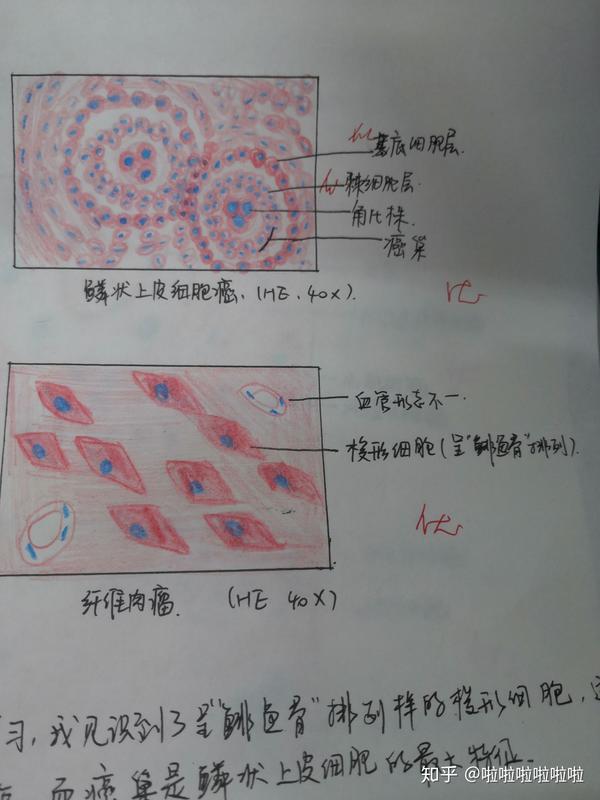 病理学切片红蓝铅笔画