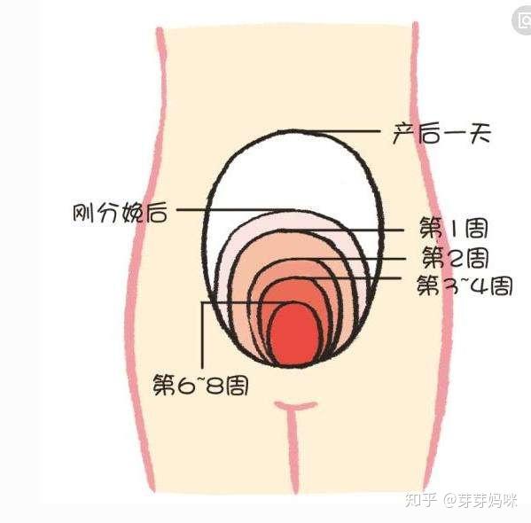 产后24小时到产后10天相当关键,一不小心就会感染导致