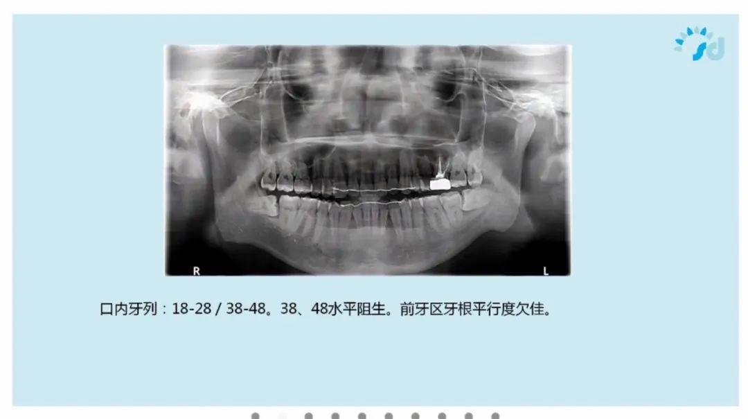 赛德阳光口腔举办隐形牙齿矫正病例研讨会