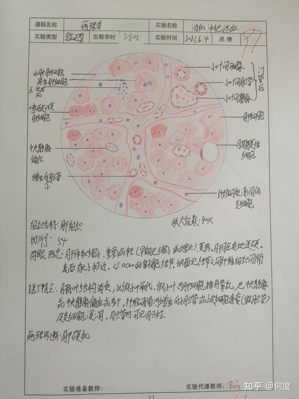 病理实验红蓝铅笔绘图