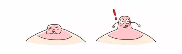 第四个特征:乳头和乳晕异常 如果乳腺癌位于或接近乳头的深处