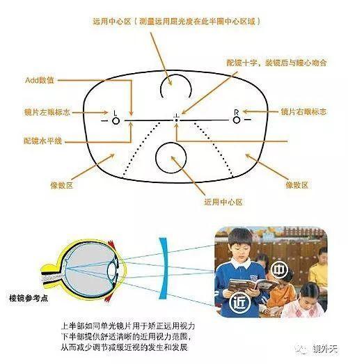 从离焦镜片对比单焦点镜片来谈预防近视