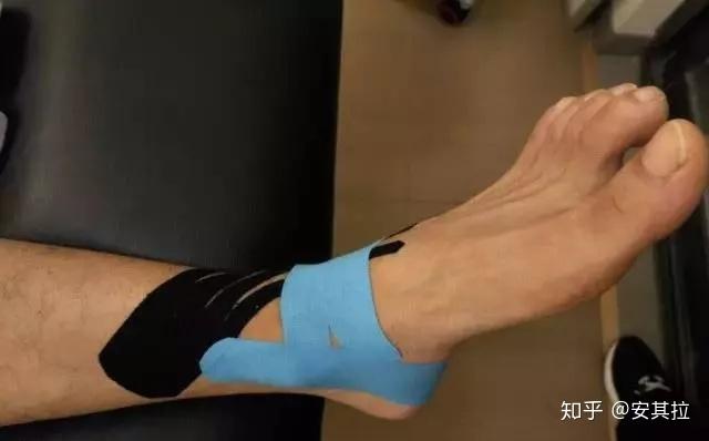 拯救脚踝扭伤的利器肌内效贴