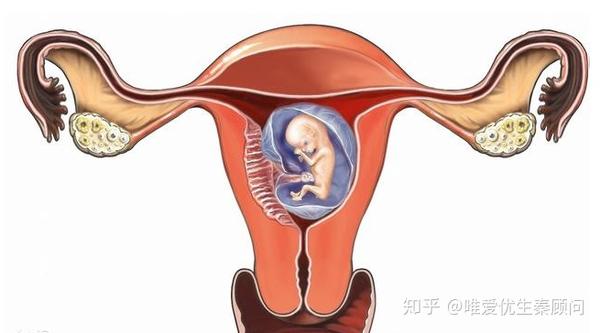 什么是单角子宫单角子宫怀孕几周最危险
