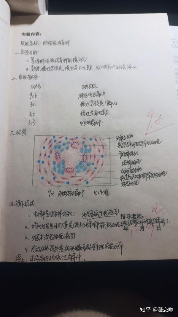 肝脂肪变性 肉芽组织 慢性肺淤血 混合血栓 炎细胞 肺结核肉芽肿