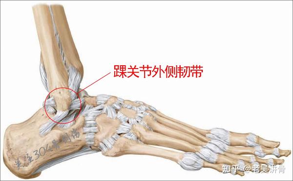 别拿崴脚不当事