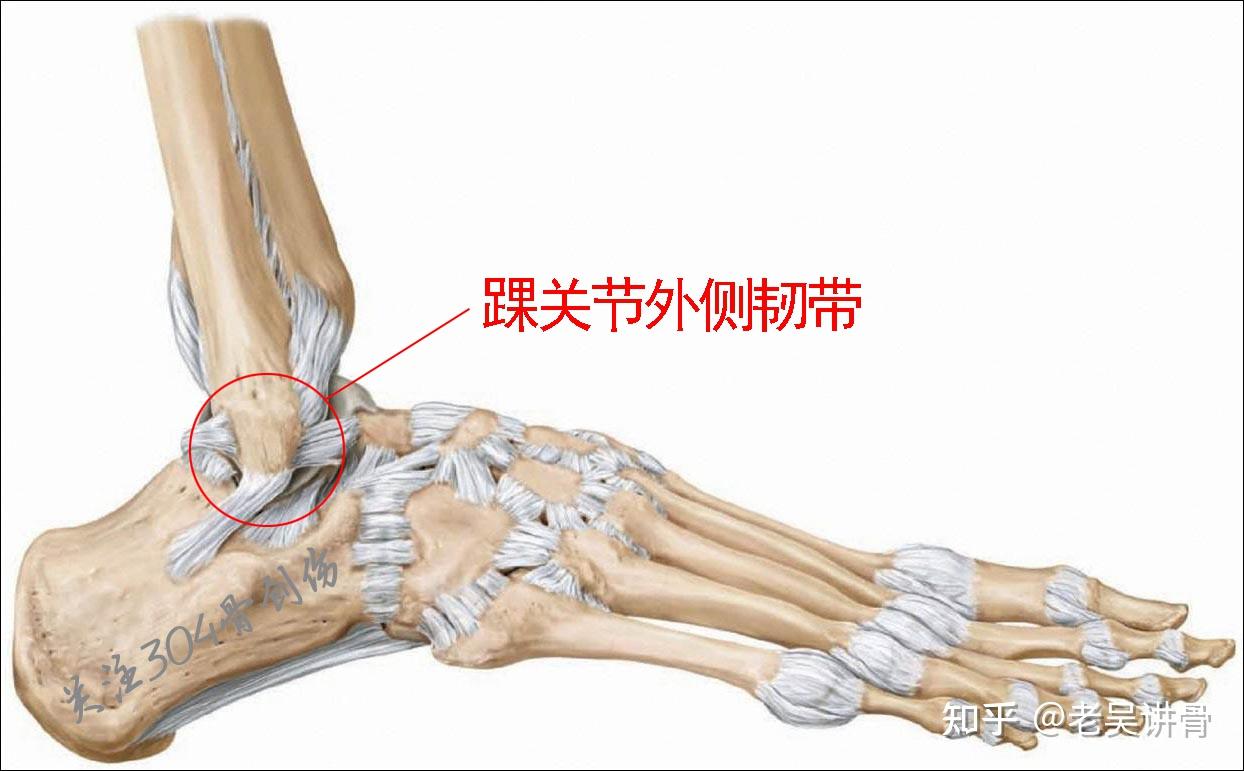组成踝关节的骨踝关节俗称"脚踝",由胫骨,腓骨和距骨构成,胫骨和腓骨
