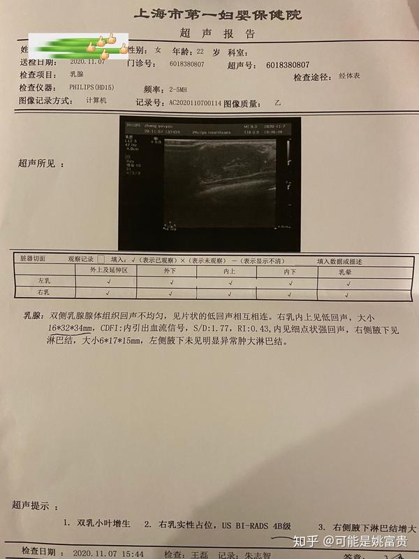 上海第一妇婴保健院乳腺手术 纤维瘤