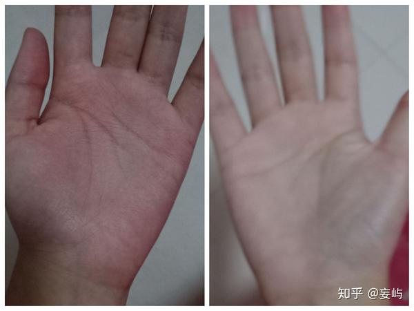 很晚的时候我妈来我房间,发现我还没有睡觉,于是打了我的手心,都肿了