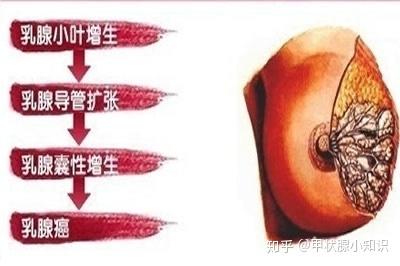 女性出现乳腺增生的几率如此之高,原因竟与它有关|王劲主任来讲解