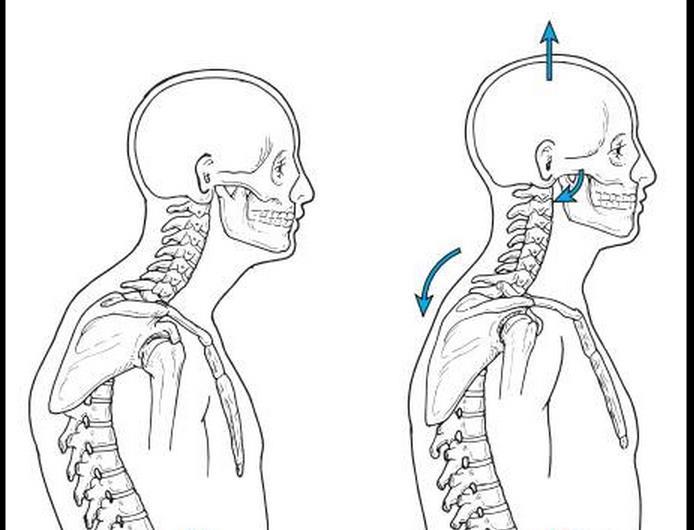 头骨 前一个就是圆肩驼背的状态,从上面的图中为我们可以看出,肩胛骨