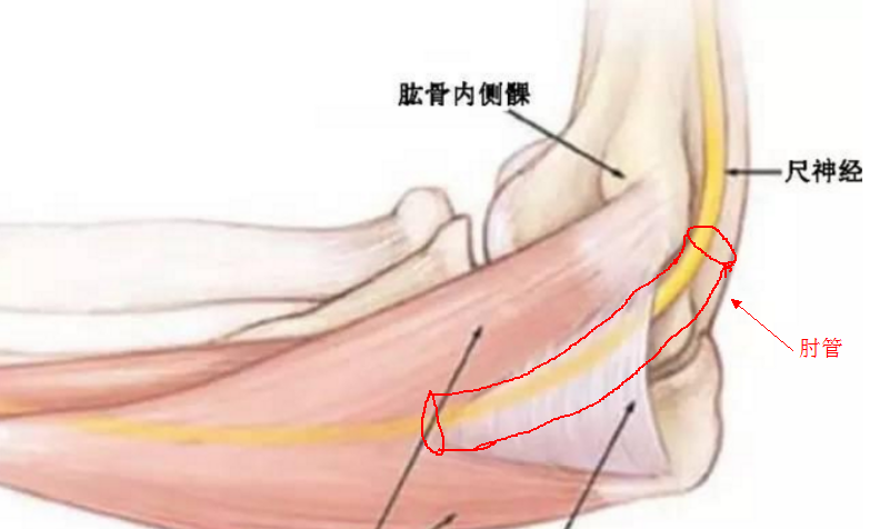 手部尺侧麻木疼痛怎么办(肘管综合征是怎么回事?