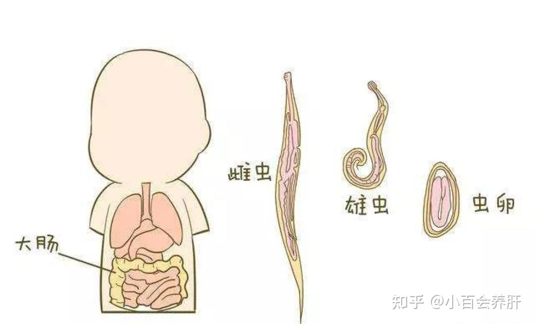 宝宝招惹上寄生虫会有哪些表现孩子打虫为什么要尽早